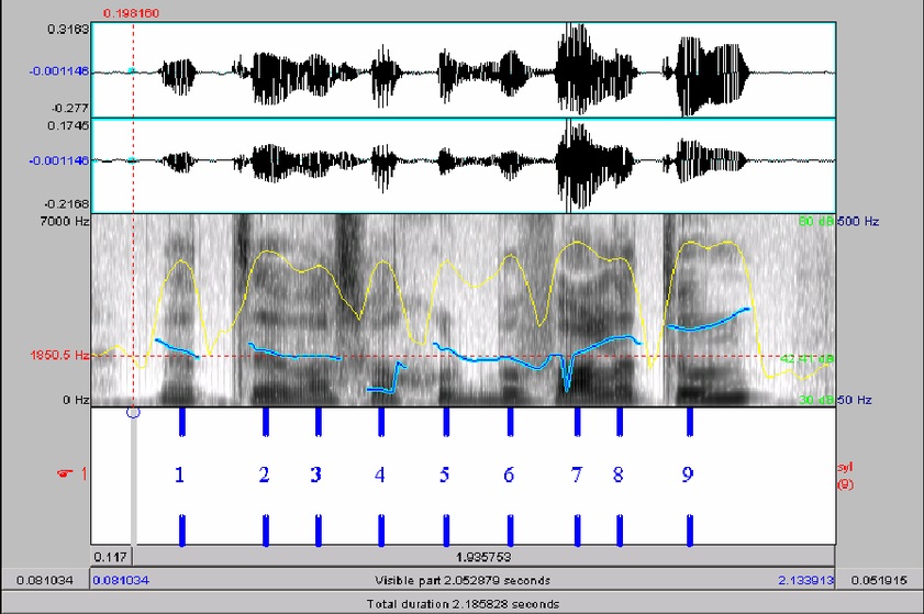 Perito en Audio en México